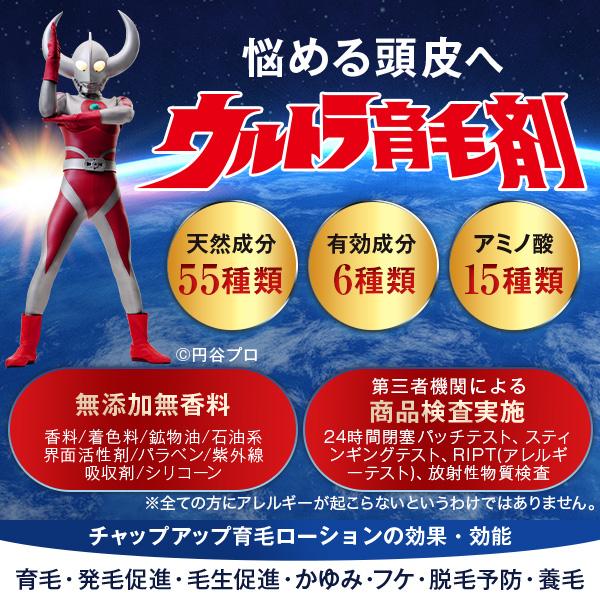 チャップアップ 公式 医薬部外品 育毛 ローション 1本 サプリ 1 チャップアップ 公式 医薬部外品 育毛 ローション 1本 サプリ 1