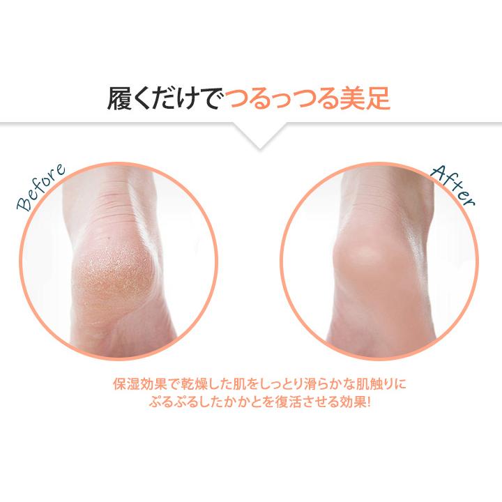 発熱ソックス 3足セット 冷えとり 発熱靴下 あったか靴下 保温 保湿効果 角質ケア かかとサポーター 健康グッズ 寒さ対策 防寒靴下 暖かい靴下 ぽかぽか Sjqi5zapgp ファッション Onurokandemirci Com