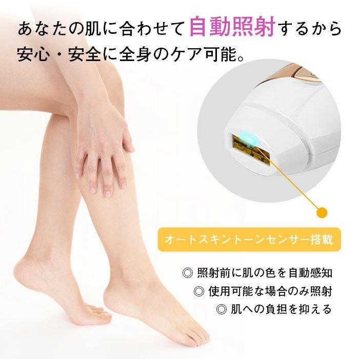 スムーズスキン ベア プラス BARE PLUS BLK 光美容器 光エステ 光脱毛 