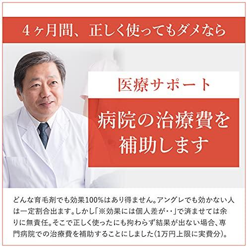アングレ ワールドセレクション INGRE 薬用育毛剤 スカルプエッセンス