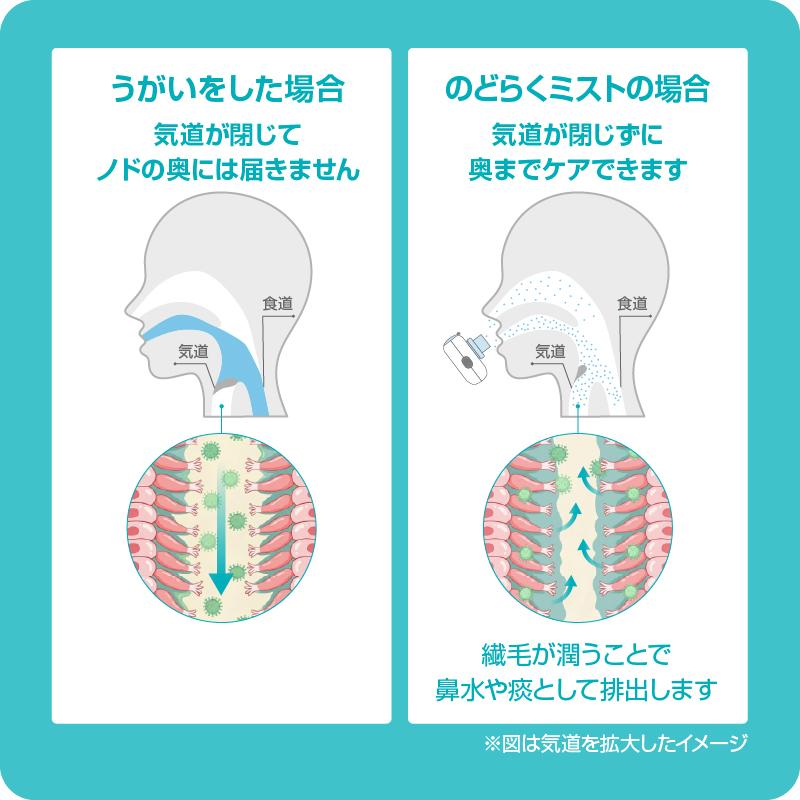 Medi Labo IHC-0402 のどらくミスト 吸入器 超音波吸入器 家庭用