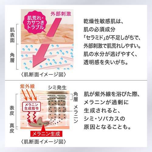 Kao（花王） キュレル シミ・ソバカス予防ケア 化粧水1(ややしっとり
