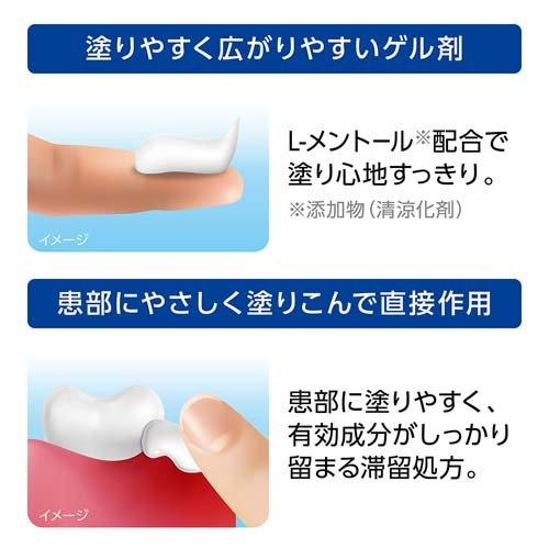 第3類医薬品)デントヘルスR ( 40g )/ デントヘルス : 爽快ドラッグ