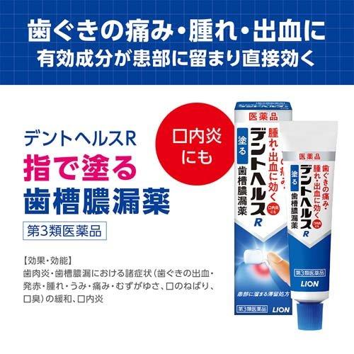 第3類医薬品)デントヘルスR ( 20g )/ デントヘルス : 爽快ドラッグ