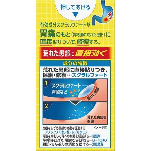 第2類医薬品)スクラート胃腸薬(錠剤) ( 36錠 )/ スクラート : 爽快