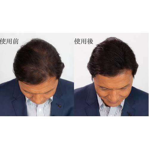 スーパーミリオンヘアーダークブラウンミストセット ( 1セット  