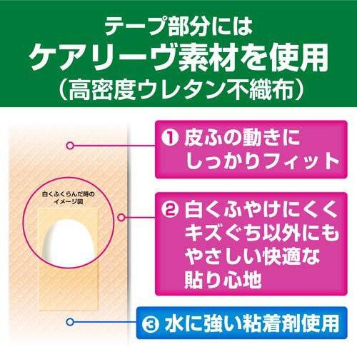 ケアリーヴ 治す力 Mサイズ CN12M ( 12枚入 )/ : 爽快ドラッグ - 通販