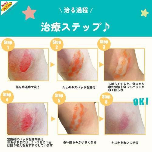 アンパンマン キャラクター ムヒのキズパッド ( 10枚入 )/ ムヒ 絆創膏