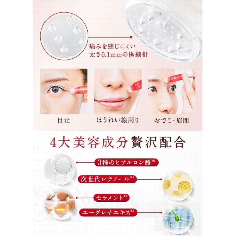 CONCリンクルインジェクション2.5ml 3本セット CONC 【公式】【10%OFF】CONC リンクルインジェクション 2.5mL 3