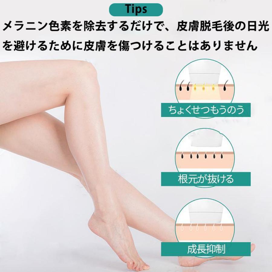 脱毛器 家庭用脱毛 脱毛機 永久 全身適用 氷感 99万発 男女兼用 5段階