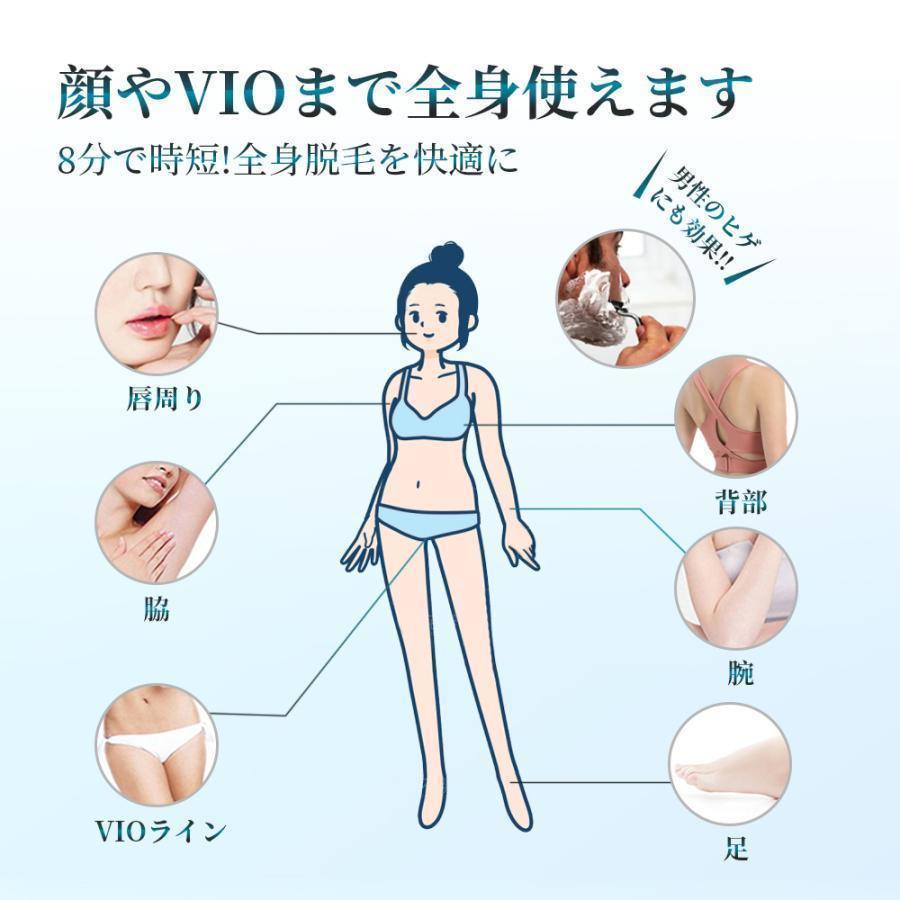 脱毛器 IPL光脱器 永久脱毛 家庭用脱毛器 自動照射 レーザー vio対応