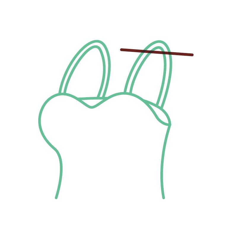 ワンピースのお直し 肩ひも調整 |  | 02