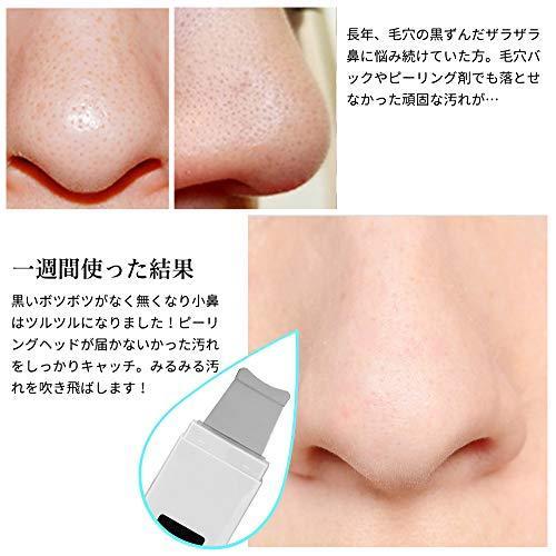 改良版 ウォーターピーリング 超音波 美顔器 Amconsure 超音波ピーリング 毛穴ケア美顔器 スマートピール イオン導入 導出 美容赤 青le S 19 Takebaster 通販 Yahoo ショッピング