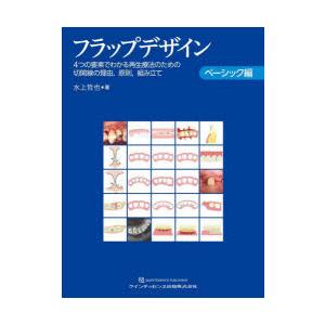 フラップデザイン 4つの要素でわかる再生療法のための切開線の理由
