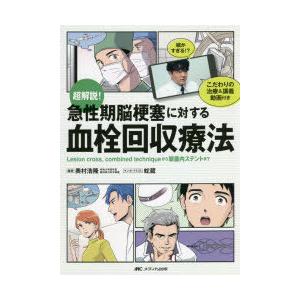超解説!急性期脳梗塞に対する血栓回収療法 Lesion cross，combined techniqueから頭蓋内ステントまで