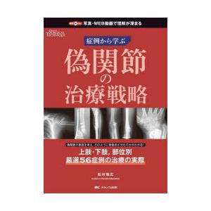 偽関節の治療戦略 症例から学ぶ