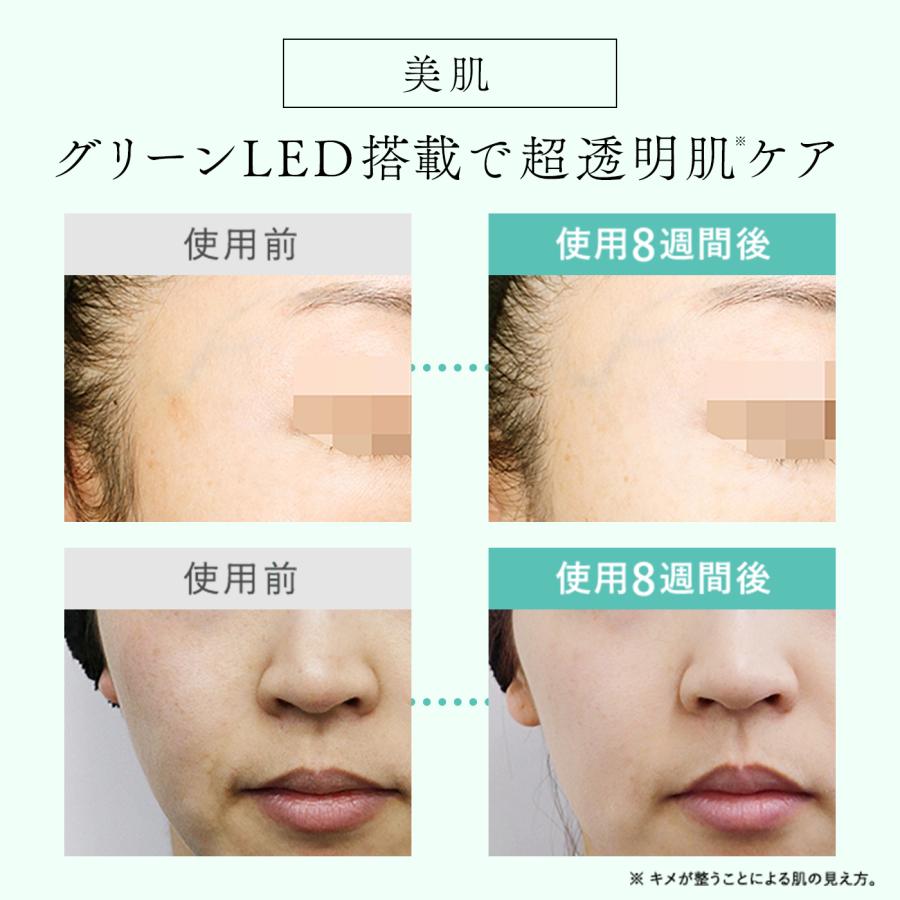 STELLA BEAUTE（ステラボーテ） 20,400円OFFクーポン発行中！【2024