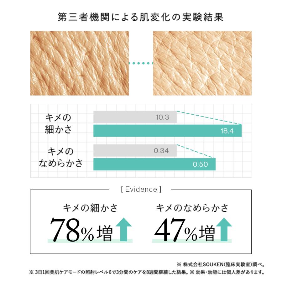 STELLA BEAUTE（ステラボーテ） 20,400円OFFクーポン発行中！【2024
