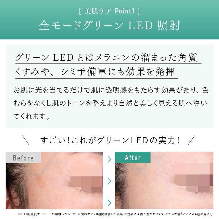 STELLA BEAUTE IPL&LED光美容器 メーカー保証付き 公式ショップ ムダ毛ケア 美肌ケア｜stellabeaute-ec｜15