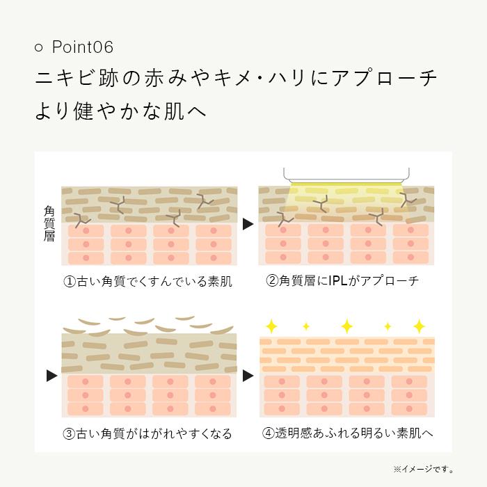 STELLA BEAUTE IPL&LED光美容器 公式 ステラボーテ ムダ毛ケア STELLA BEAUTE IPL&LED光美容器 公式 ステラボーテ ムダ毛ケア