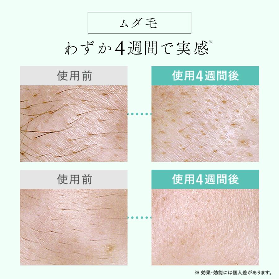 STELLA BEAUTE（ステラボーテ） 20,400円OFFクーポン発行中！【2024