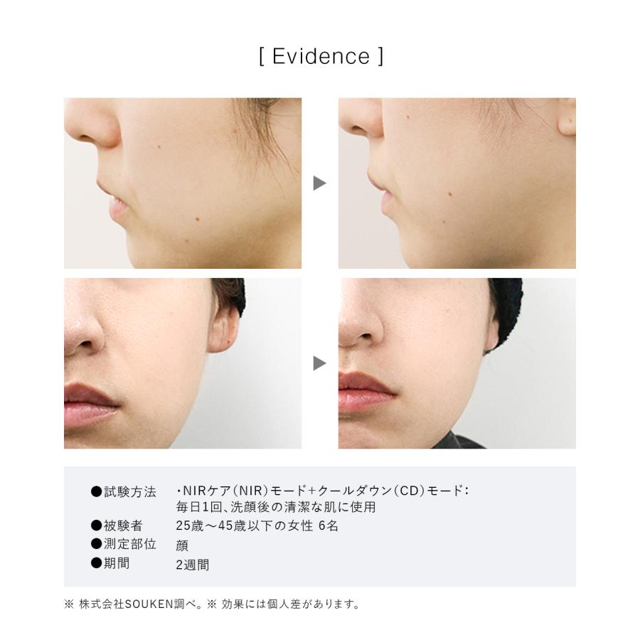 2026NEWモデル】IPL&NIR光美容器 PRO IPL光美容器 NIR 脱毛器 グリーン