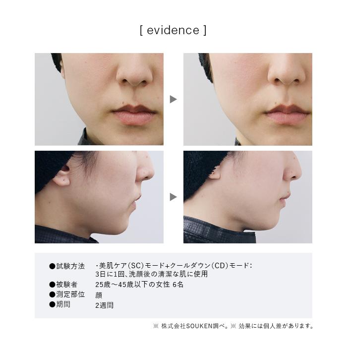 3/31発売＞【2026モデル】IPL&NIR光美容器 PRO IPL光美容器 NIR 脱毛器
