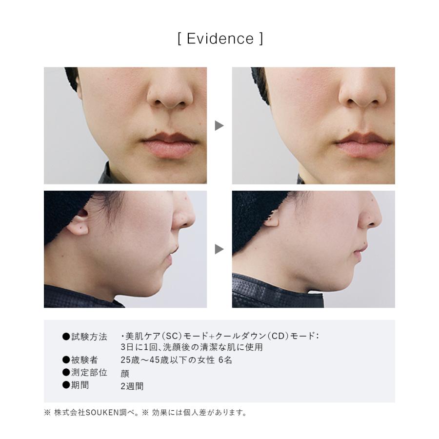 2026NEWモデル】IPL&NIR光美容器 PRO IPL光美容器 NIR 脱毛器 グリーン
