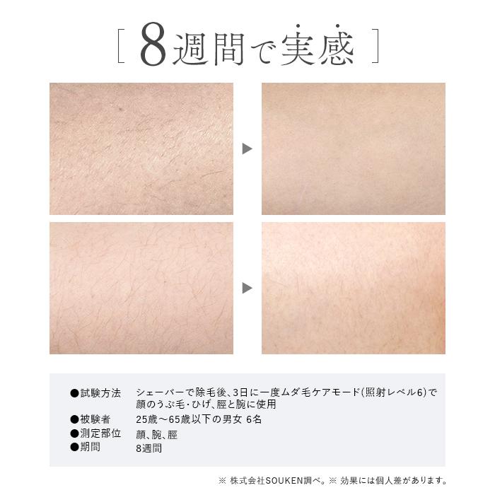3/31発売＞【2026モデル】IPL&NIR光美容器 PRO IPL光美容器 NIR 脱毛器