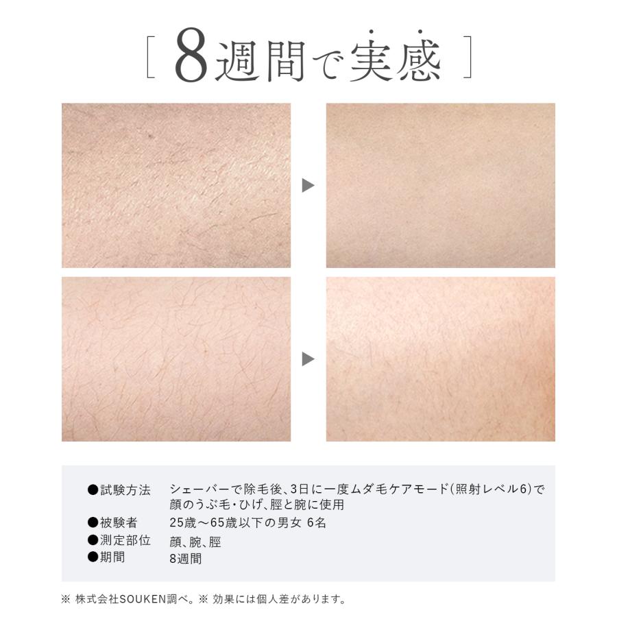 2026NEWモデル】IPL&NIR光美容器 PRO IPL光美容器 NIR 脱毛器 グリーン