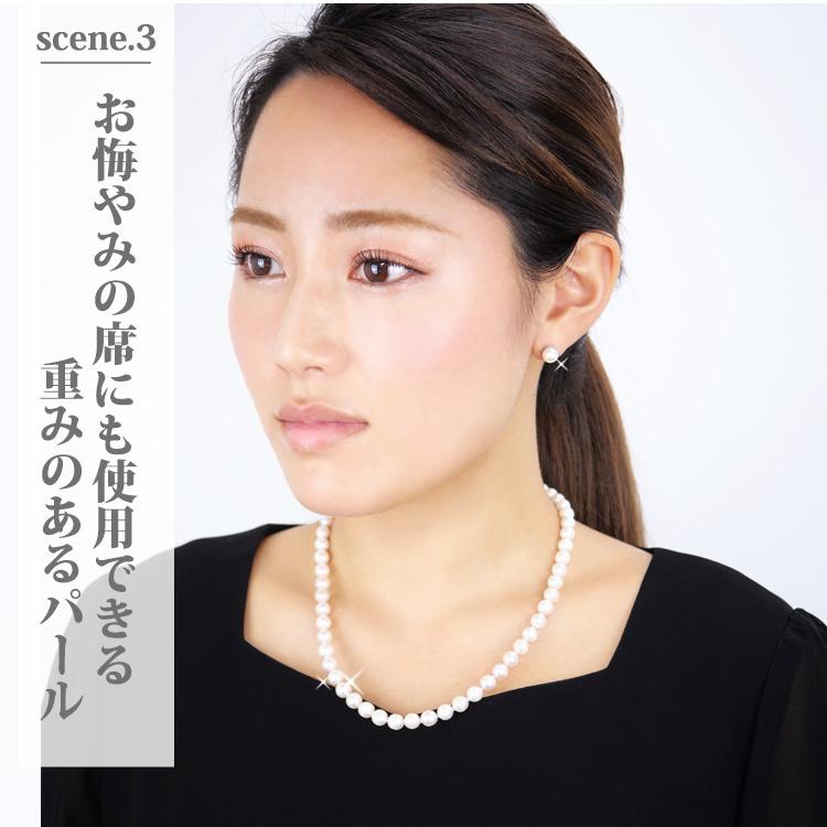 売却済み　511　あこや真珠　8mm　訳あり　ネックレス　サージカルステンレス 金属アレルギー対応 ステンレスネックレス あこや真珠ネックレス 入学