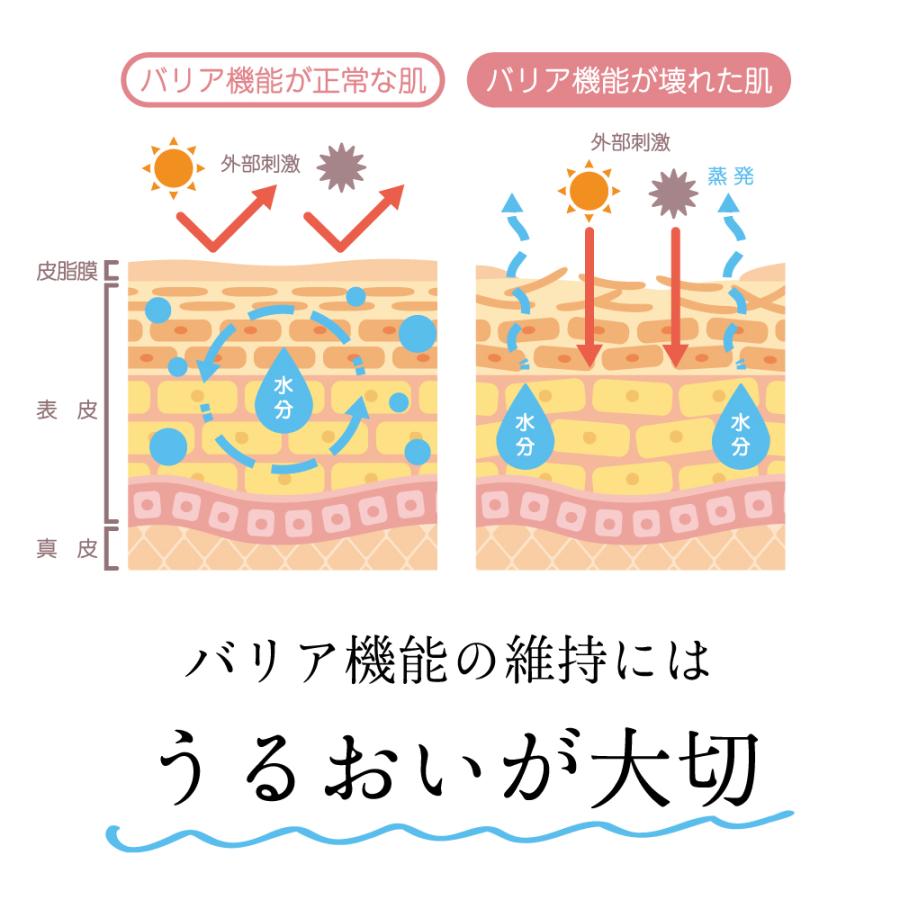 化粧水 敏感肌 金属アレルギー対応 レディース モイスチャータイプ 日本製 スキンアップローション 爆買 |  | 07