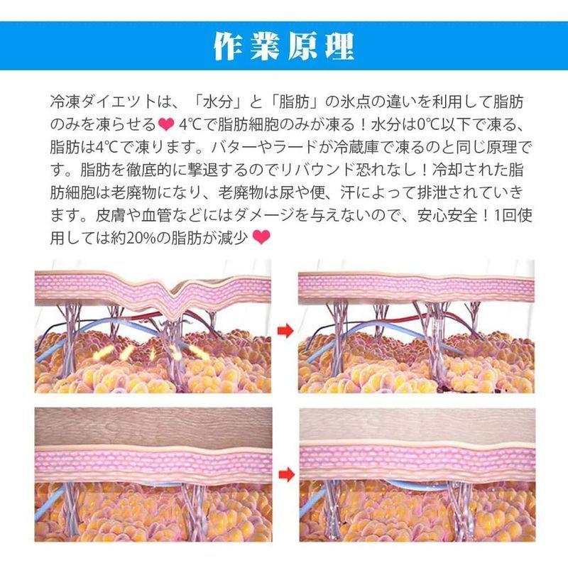 家庭キャビテーション 冷凍ダイエットマシンcryolipolysis 脂