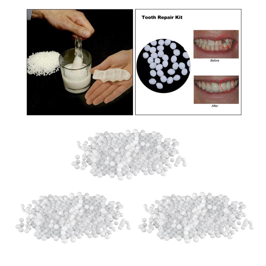サーマルビーズ100g歯ベニア成形可能義歯仮歯修復 予約販売