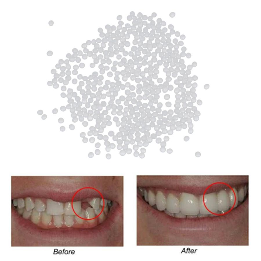 サーマルビーズ歯ベニア成形可能義歯仮歯修復ツール20g :62031369:STKショップ - 通販 - Yahoo!ショッピング