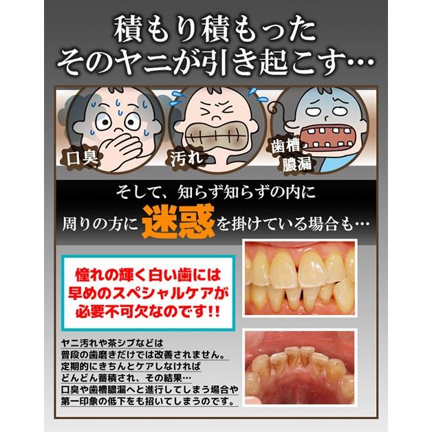 ホワイトニング セルフ 自宅 ホワイトニング デンタルホワイトニングプロ 替用スポンジ 30ヶ入り 歯石 除去 口臭対策 口臭予防 歯槽膿漏 ヤニ取り ポイント消化 T 329 ビューティーヤフーショッピング店 通販 Yahoo ショッピング