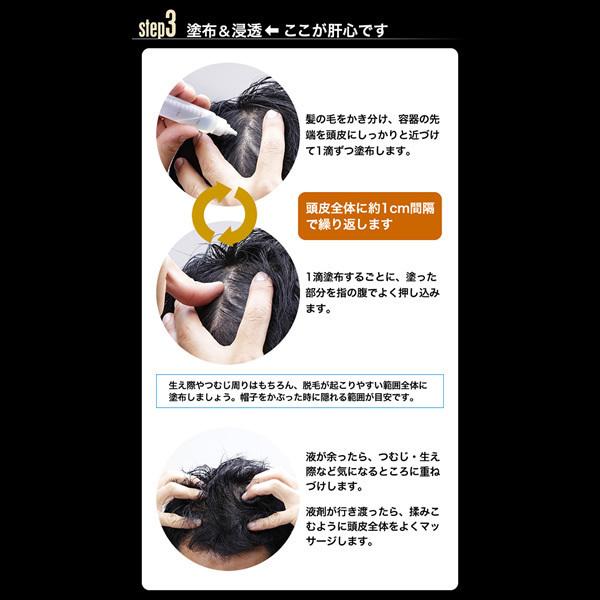 育毛サロン発 男性用薬用育毛剤 バイオテック プレミアム メディケイ 