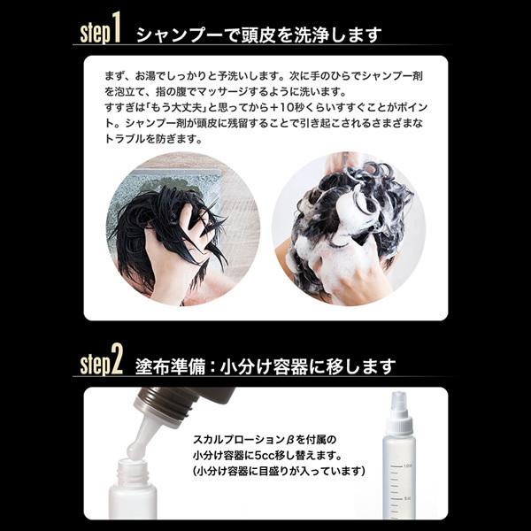 育毛サロン発 男性用薬用育毛剤 バイオテック プレミアム メディケイテッド スカルプローションβ 150ml×3本 医薬部外品 日本製　育毛 養毛 抜け毛 薄毛 頭皮 | ブランド登録なし | 12