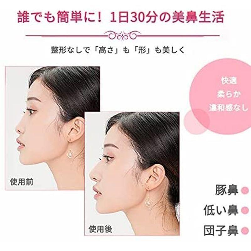 ノーズクリップ 鼻筋セレブ 鼻高く 美鼻 鼻筋矯正 鼻栓 鼻痩せ 鼻小さく 美鼻矯正器具 団子鼻 豚鼻 低い鼻 小鼻 補正 整形 簡単 手軽 ストレージリク 通販 Yahoo ショッピング