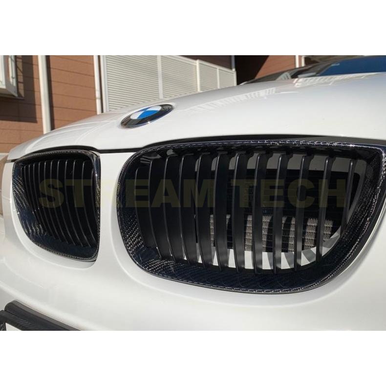 BMW E81 E82 E87 E88 1シリーズ 後期 LCI用 リアルカーボン キドニー