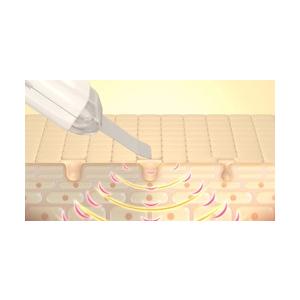 送料無料 CosBeauty 美顔器 アクリアルピーリングプロ ワイン