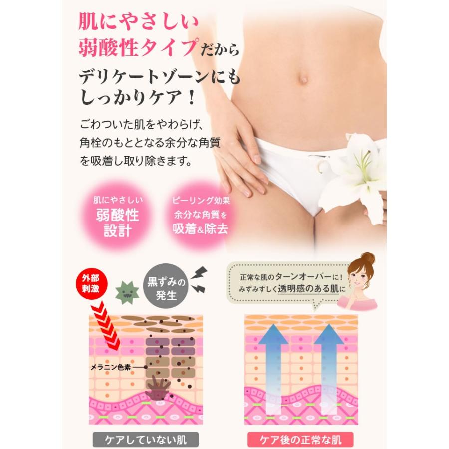 ピーリングジェル デリケートゾーン ミルク 弱酸性 クリーム 乳首 バストトップ ボディクリーム バスト 胸 陰部 380g Zyakpleeen 素肌べっぴん館 通販 Yahoo ショッピング