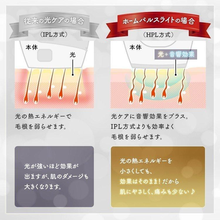 IRIS OHYAMA（アイリスオーヤマ） 脱毛器 家庭用 女性 光脱毛 Vライン