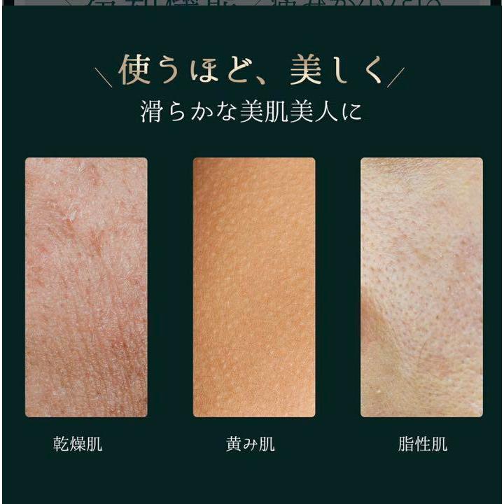 Omuse 光美容器 脱毛器 IPL光脱毛 : sun lise - 通販 - Yahoo!ショッピング