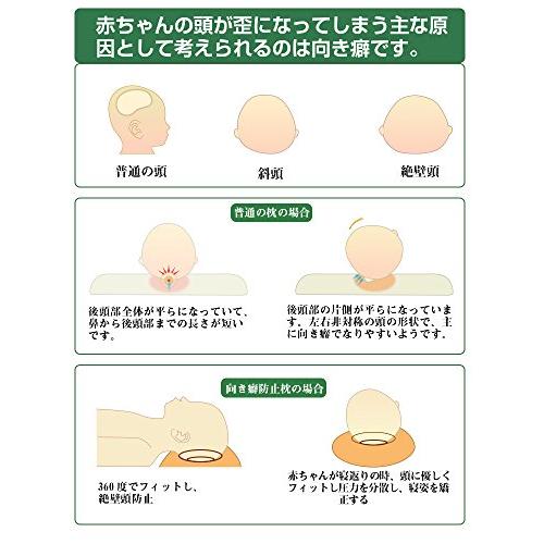 22年最新入荷 ベビー用寝具 ベッド Adokoo Adokoo ベビーまくら 向き癖防止枕 絶壁頭 斜頭 変形 猫背 寝姿を矯 正 頭の形が良くなる 男女兼用 汗とり 快眠 Www Threeriversofs Com