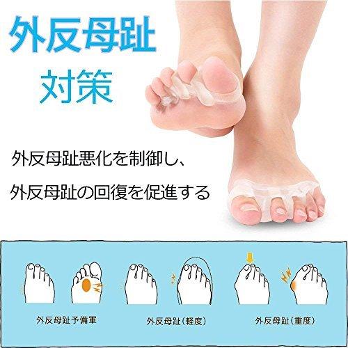 足 指 広げる パッド 浮き指 内反小趾 矯正 健康グッズ Sukwii フットケア 足 指 セパレーター 足のゆび ひろげる シリコン製 男女兼用 5本指 2足組セット A B07gnwmbwv 2723 太陽4号ヤフー店 通販 Yahoo ショッピング