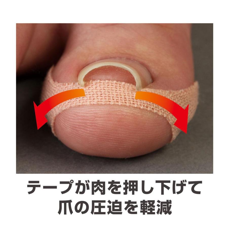 サイプラス 巻き爪テープクイこまなーい 10枚入り : サンドラッグe