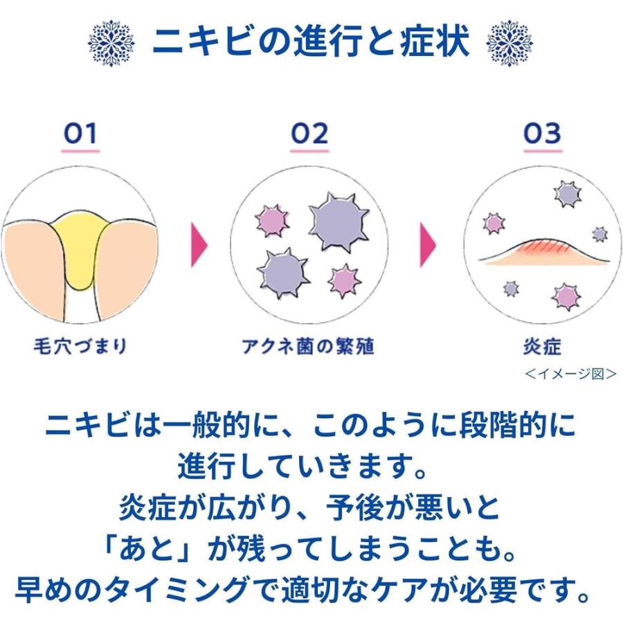 第一三共ヘルスケア 【第2類医薬品】第一三共ヘルスケア マキロンアク