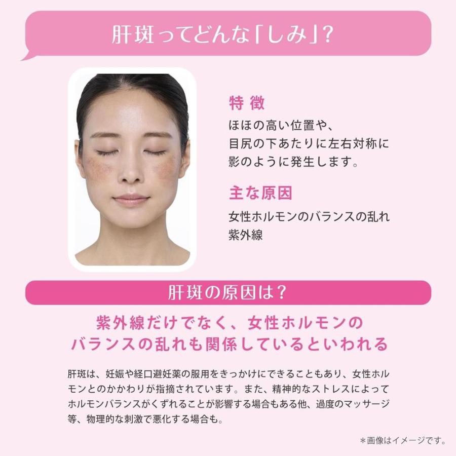 第一三共ヘルスケア 【第1類医薬品】第一三共 トランシーノEX 240錠