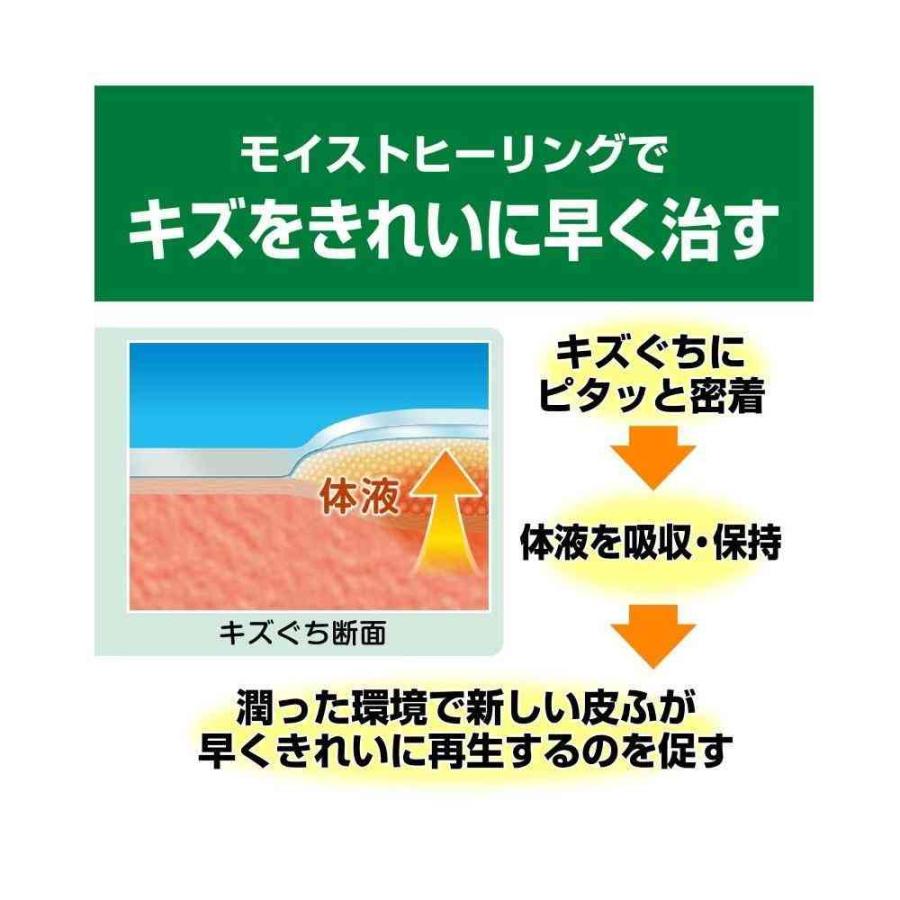 ケアリーヴ 【管理医療機器】ニチバン ケアリーヴ治す力 CN12M M-12枚